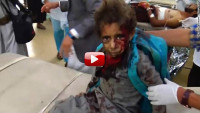 (ნახეთ ვიდეო) სასწრაფოდ ამწუთებში, იემენში ბომბმა 50 ბავშვის სიცოცხლე იმსხვერპლა :O